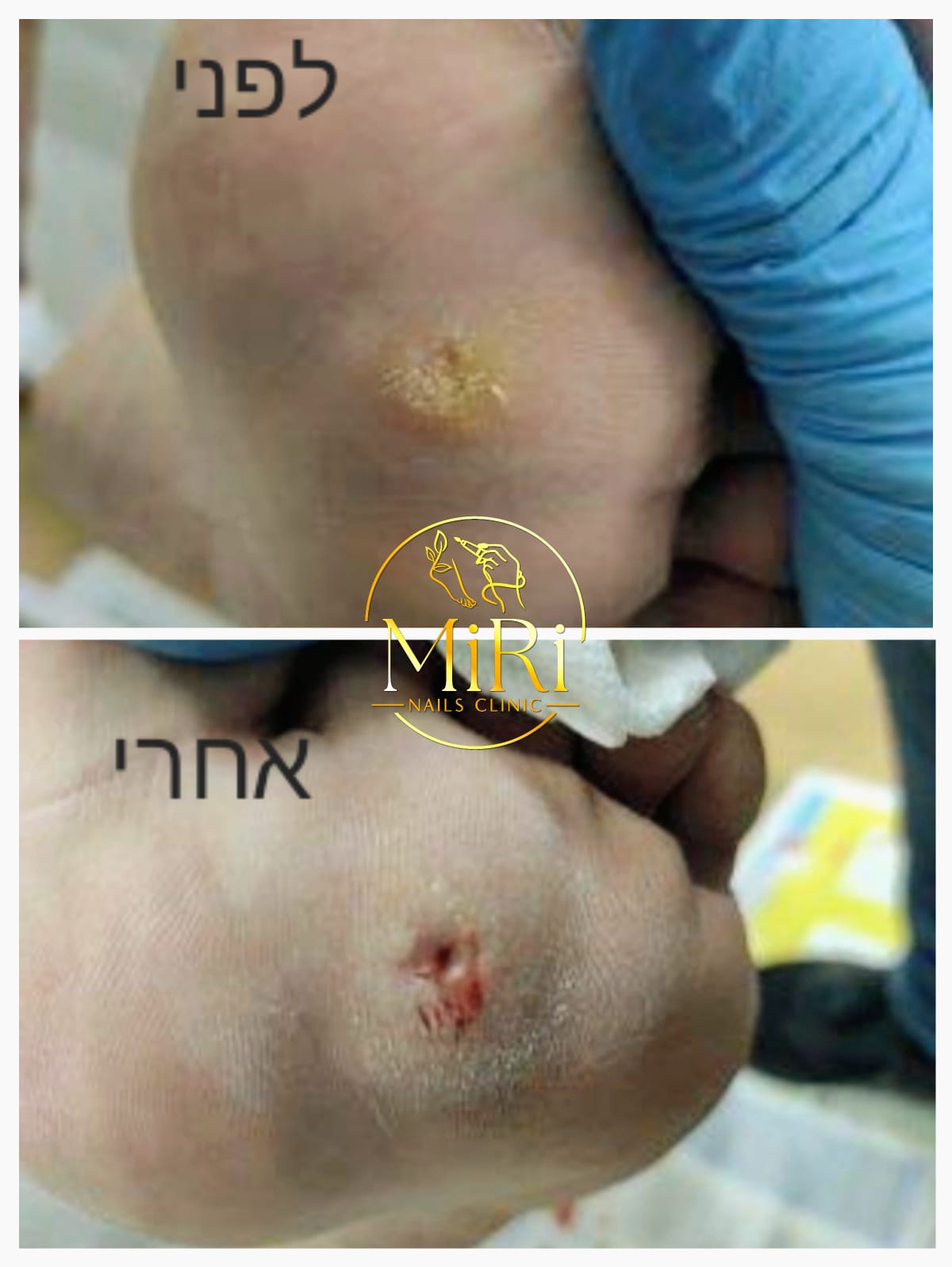 תוצאת טיפול בקליניקה — לפני ואחרי
